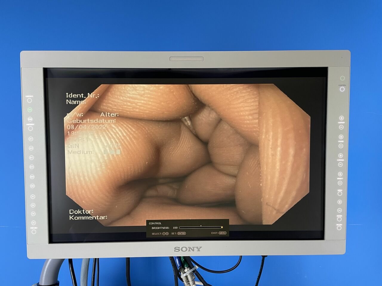 Olympus CV180 Video Endoscopy